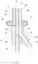 Fig. 04 - Multilumen Curved Split-tip Catheter