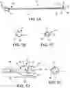 Fig. 02 - CATHETER APPARATUS AND METHODS FOR TREATING VASCULATURES