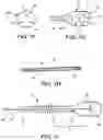 Fig. 03 - CATHETER APPARATUS AND METHODS FOR TREATING VASCULATURES