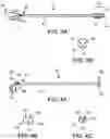Fig. 06 - CATHETER APPARATUS AND METHODS FOR TREATING VASCULATURES