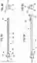 Fig. 07 - CATHETER APPARATUS AND METHODS FOR TREATING VASCULATURES