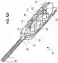 Fig. 18 - CATHETER APPARATUS AND METHODS FOR TREATING VASCULATURES
