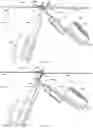 Fig. 07 - System for anchoring medical devices