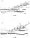 Fig. 08 - System for anchoring medical devices