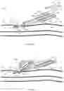 Fig. 09 - System for anchoring medical devices