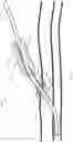 Fig. 15 - System for anchoring medical devices
