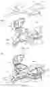 Fig. 16 - System for anchoring medical devices