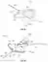 Fig. 07 - Compliant catheter adapter having self-slitting needle