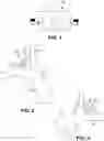 Fig. 02 - Devices and Methods for Treating Congestive Heart Failure, Ascites, and Other Disorders Relating to Excess Bodily Fluid