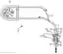 Fig. 01 - Systems and methods for treating pulmonary edema