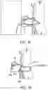 Fig. 15 - Systems and methods for treating pulmonary edema