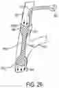 Fig. 19 - Systems and methods for treating pulmonary edema