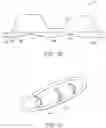 Fig. 10 - Implantable medical device for improved placement and adherence in the body