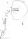 Fig. 02 - Catheter system for draining a bodily fluid from a fluid source in a body