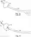 Fig. 13 - Catheter system for draining a bodily fluid from a fluid source in a body