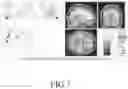 Fig. 08 - SYSTEM FOR TRAINING VISUAL ACUITY