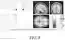 Fig. 10 - SYSTEM FOR TRAINING VISUAL ACUITY