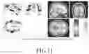 Fig. 12 - SYSTEM FOR TRAINING VISUAL ACUITY
