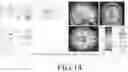 Fig. 15 - SYSTEM FOR TRAINING VISUAL ACUITY