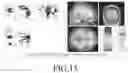 Fig. 16 - SYSTEM FOR TRAINING VISUAL ACUITY