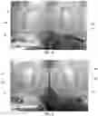Fig. 04 - Biomedical electrode with anti-microbial properties