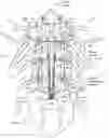 Fig. 01 - Methods and systems for implanting a neuromodulation system at a surgically open spinal treatment site