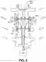 Fig. 08 - Methods and systems for implanting a neuromodulation system at a surgically open spinal treatment site