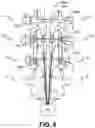 Fig. 09 - Methods and systems for implanting a neuromodulation system at a surgically open spinal treatment site
