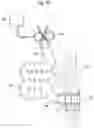 Fig. 03 - System for treating a patient having an intestinal disorder