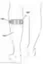 Fig. 01 - Dynamic control of transcutaneous electrical nerve stimulation therapy using continuous sleep detection