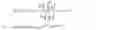 Fig. 03 - Fast objective fitting measurements for cochlear implants