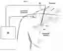 Fig. 01 - Systems and methods to place one or more leads in tissue for providing functional and/or therapeutic stimulation