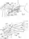 Fig. 04 - Systems and methods to place one or more leads in tissue for providing functional and/or therapeutic stimulation