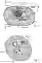 Fig. 25 - Systems and methods to place one or more leads in tissue for providing functional and/or therapeutic stimulation