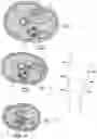 Fig. 26 - Systems and methods to place one or more leads in tissue for providing functional and/or therapeutic stimulation