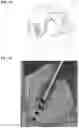 Fig. 05 - Treatment for loss of control disorders