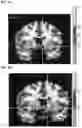 Fig. 13 - Treatment for loss of control disorders
