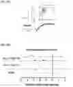 Fig. 31 - Treatment for loss of control disorders