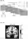 Fig. 34 - Treatment for loss of control disorders
