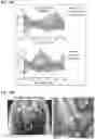 Fig. 35 - Treatment for loss of control disorders