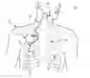 Fig. 01 - Method and system for applying stimulation in treating sleep disordered breathing
