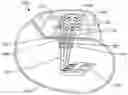 Fig. 01 - Method of manufacturing a singulated feedthrough insulator for a hermetic seal of an active implantable medical device incorporating a post conductive paste filled pressing step