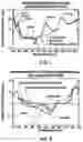 Fig. 07 - Attachable tip for electromagnetic hand piece