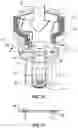 Fig. 09 - Attachable tip for electromagnetic hand piece
