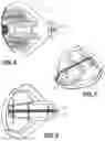 Fig. 06 - Golf club with polymeric insert and removable weight