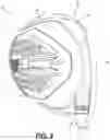 Fig. 03 - Golf club head with polymeric insert