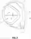 Fig. 04 - Golf club head with polymeric insert