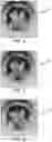 Fig. 05 - INFRARED LEAK DETECTION SYSTEM