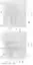 Fig. 09 - Small volume self-metered blood separation device