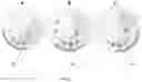 Fig. 07 - Automated point-of-care devices for complex sample processing and methods of use thereof